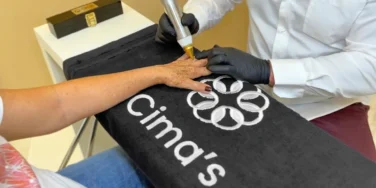 Um profissional aplicando o Método Cima’s em uma paciente. A imagem mostra uma mão de uma paciente repousando sobre uma toalha preta com o logotipo ‘Cima’s’. Um profissional, vestindo uma camisa branca e luvas pretas, está aplicando o tratamento usando um dispositivo portátil, em formato de caneta, com uma ponta dourada. O ambiente parece ser um local profissional, como uma clínica ou spa, devido à sua aparência limpa e organizada.
