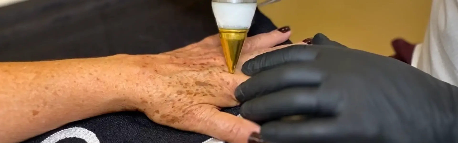 metodo-cimas-tratamento