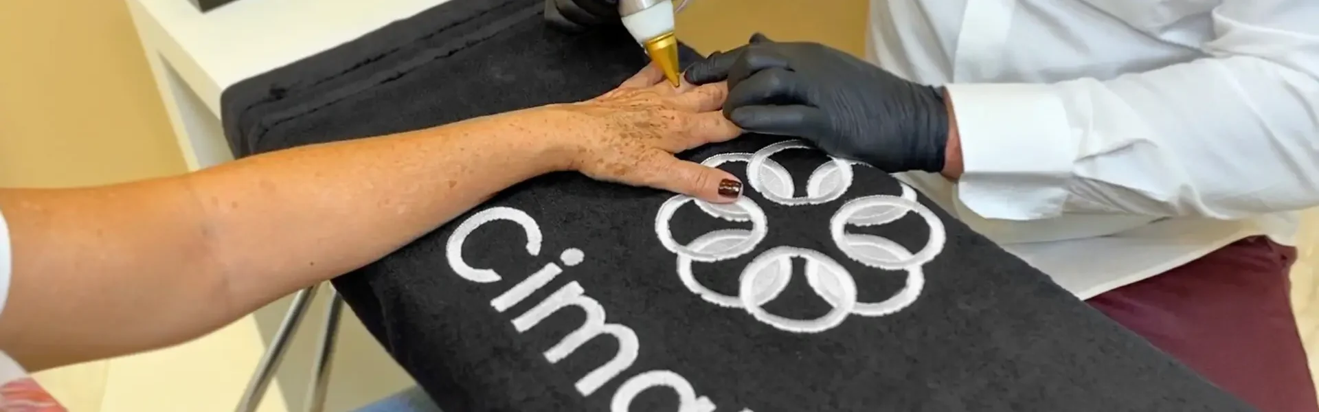 Um profissional aplicando o Método Cima’s em uma paciente. A imagem mostra uma mão de uma paciente repousando sobre uma toalha preta com o logotipo ‘Cima’s’. Um profissional, vestindo uma camisa branca e luvas pretas, está aplicando o tratamento usando um dispositivo portátil, em formato de caneta, com uma ponta dourada. O ambiente parece ser um local profissional, como uma clínica ou spa, devido à sua aparência limpa e organizada.